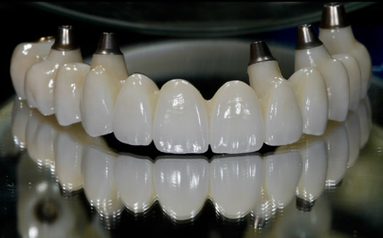 B & D Dental Technologies - Proto3000 Online Store 