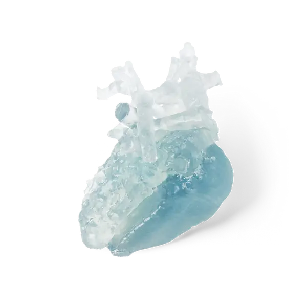 Image shows heart aorta 3D-printed with BioMed Flex 80A Resin