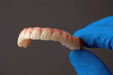 Image shows a 3D printed denture produced with Formlabs Premium Teeth resin