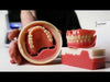 Milling Digital Dentures | vhf R5 Ivoclar Ivotion Dentures