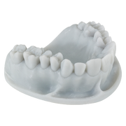 Dental model 3D-printed with Keystone KeyPrint® KeyOrthoModel - Proto3000 Online Store