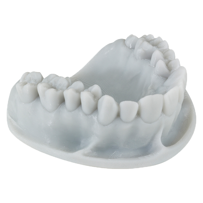 Dental model 3D-printed with Keystone KeyPrint® KeyOrthoModel - Proto3000 Online Store