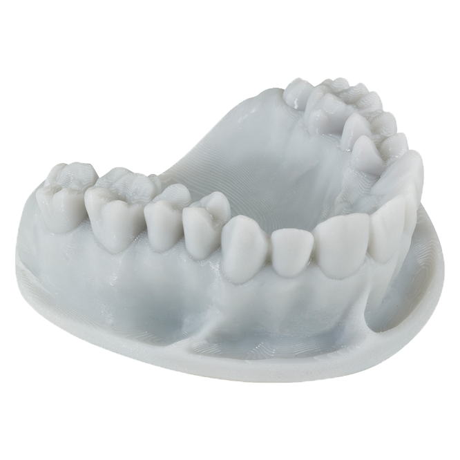 Dental model 3D-printed with Keystone KeyPrint® KeyOrthoModel - Proto3000 Online Store 