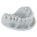 Dental model 3D-printed with Keystone KeyPrint® KeyOrthoModel - Proto3000 Online Store 