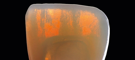 VITA SUPRINITY® PC | 14 mm, 5-Pack - Proto3000 Online Store 