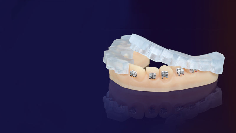 Keystone KeyPrint® KeyOrtho IBT™ for indirect bonding trays- Proto3000 Online Store