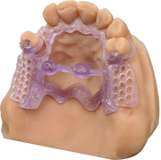 Keystone KeyPrint® KeyCast® - Proto3000 Online Store