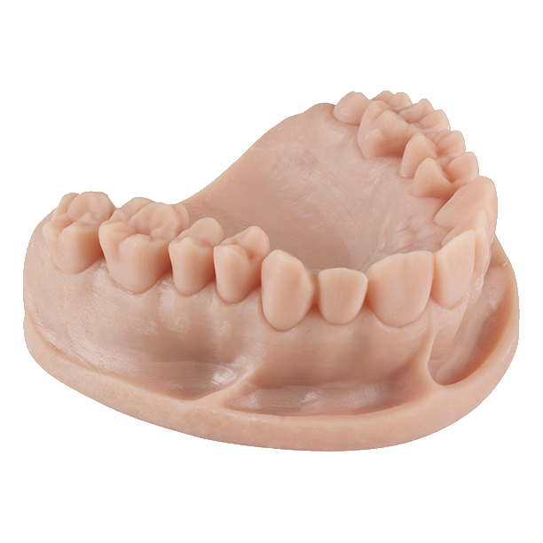 Dental 3D application with Keystone KeyPrint® KeyModel® - Proto3000 Online Store 