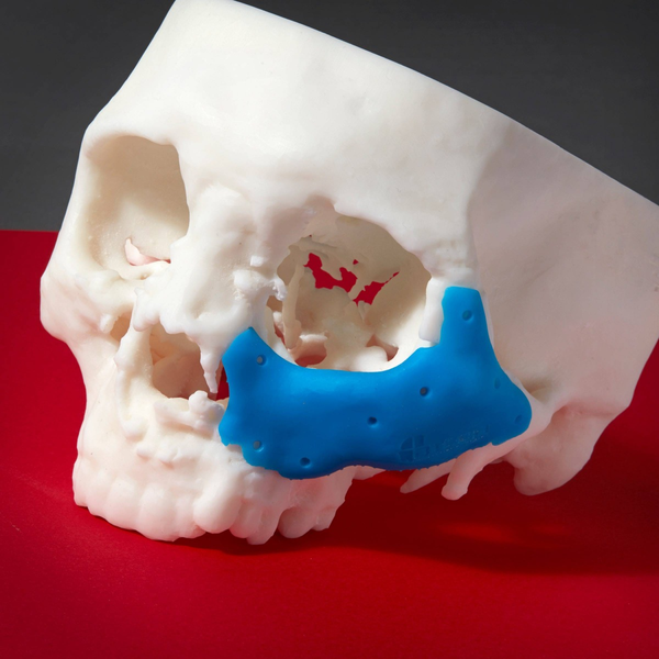 Image shows medical skull model with a 3D printed part with Formabs Cyan Color Pigment